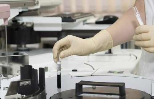 Onion, fenugreek secrets revealed for diabetics